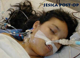 Yesica after botched operation
