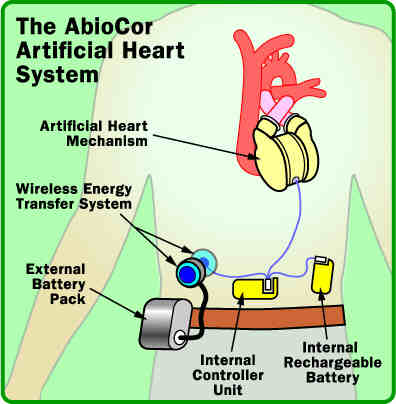 the Abocor system